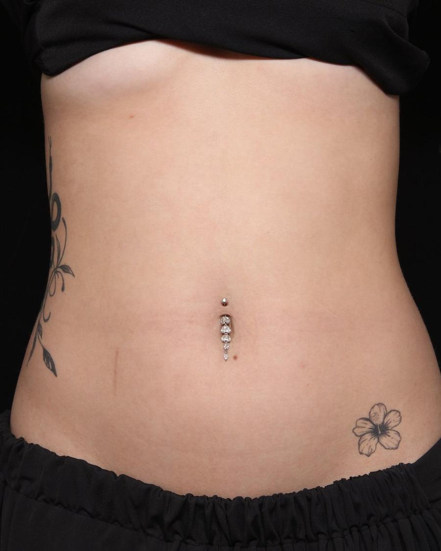 Lymphatic Drainage before