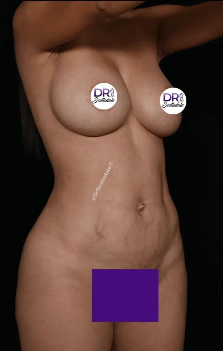 Scottsdale Skinny after