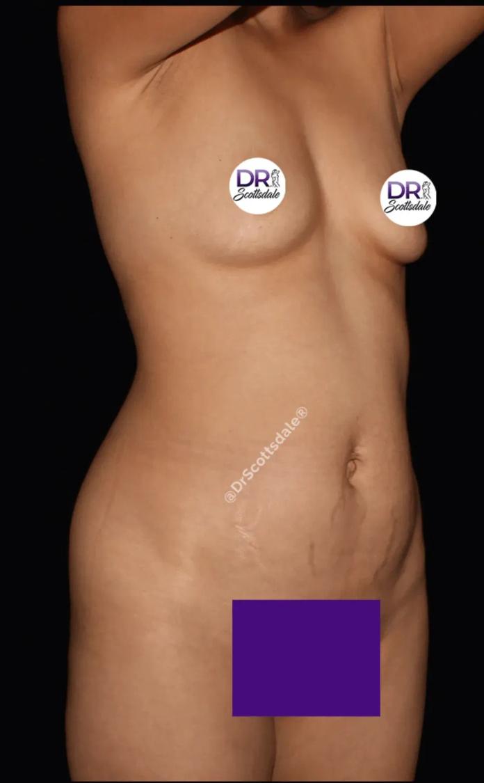 Scottsdale Skinny before