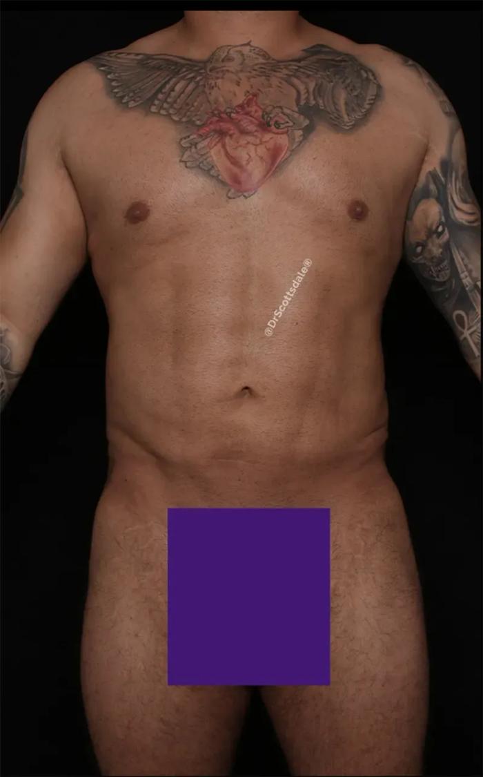After Gladiator