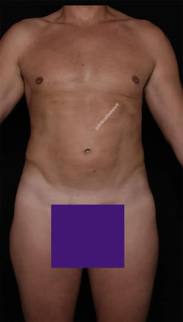 After Gladiator