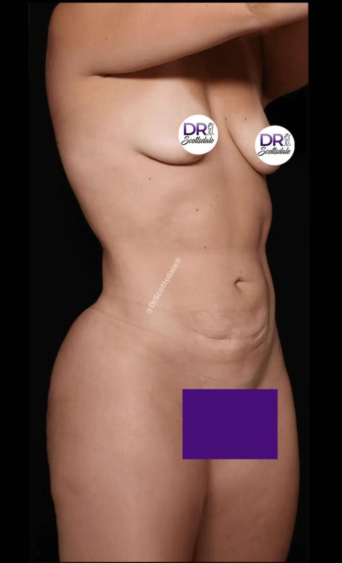 Scottsdale Skinny after