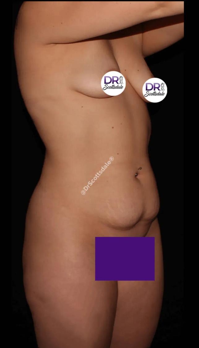 Scottsdale Skinny before