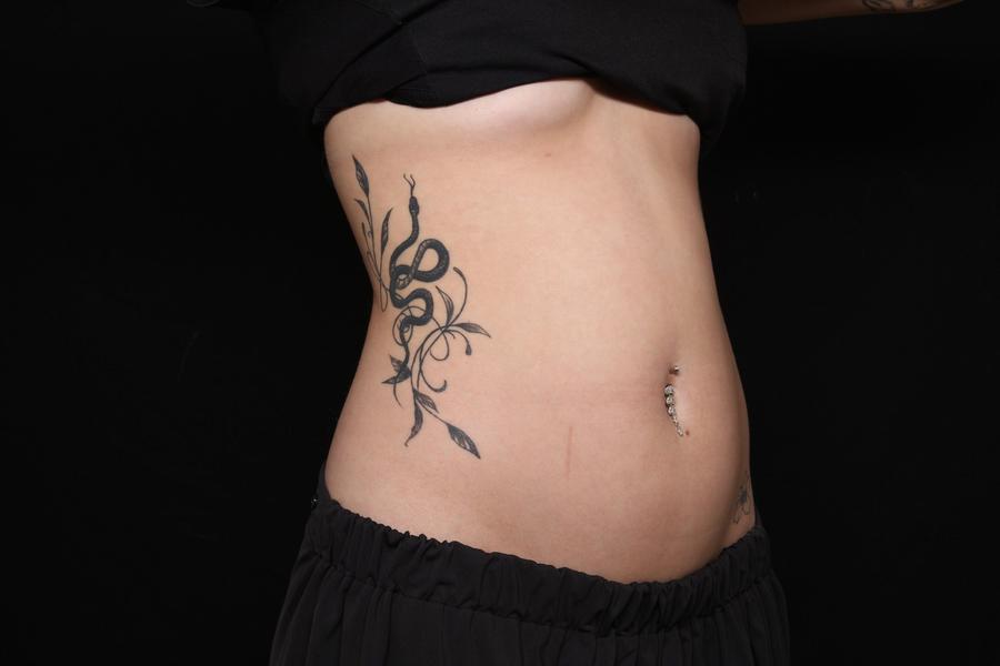 Lymphatic Drainage before