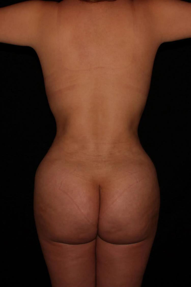 Scottsdale Skinny after