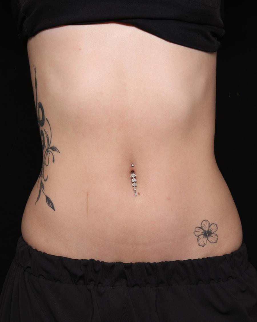 Lymphatic Drainage after
