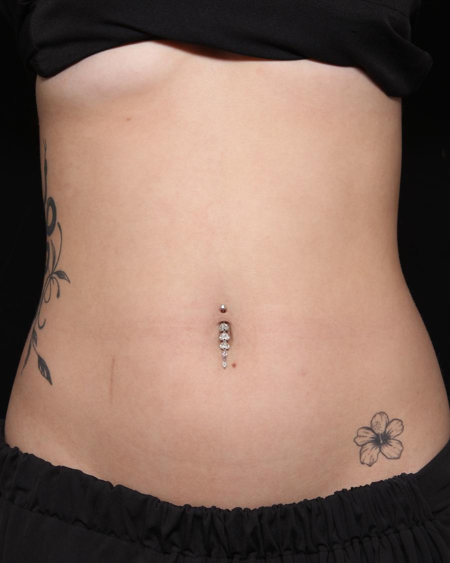 Lymphatic Drainage before
