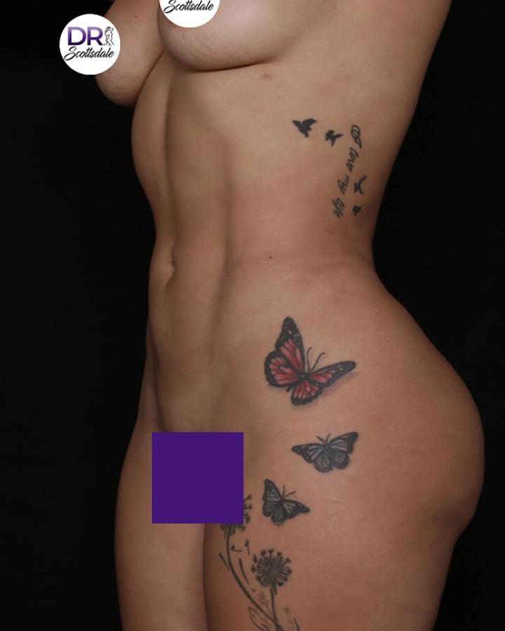 Scottsdale Skinny after