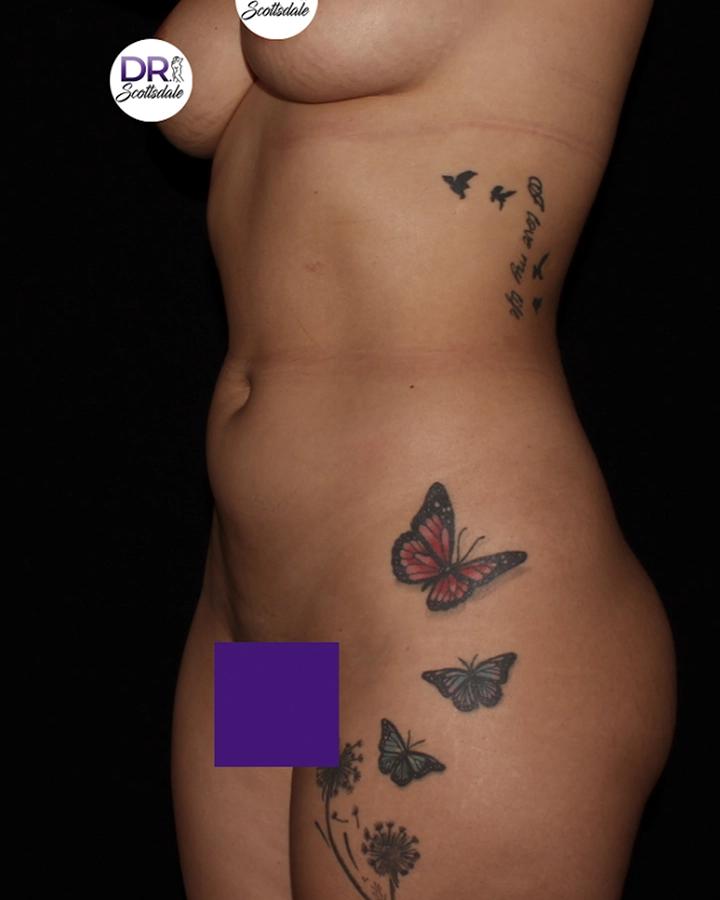 Scottsdale Skinny before