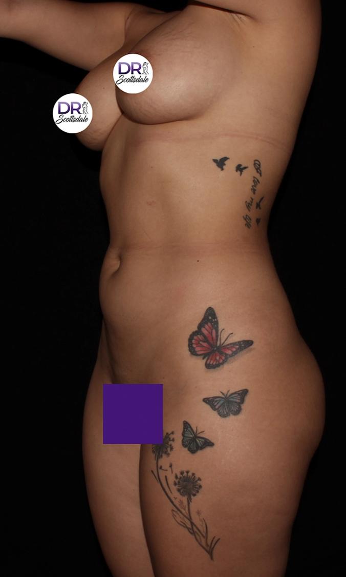 Scottsdale Skinny before