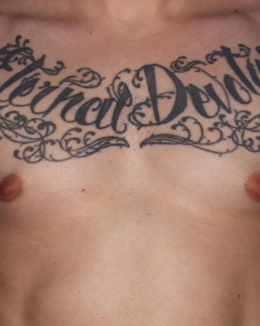 One-Stitch Gynecomastia before