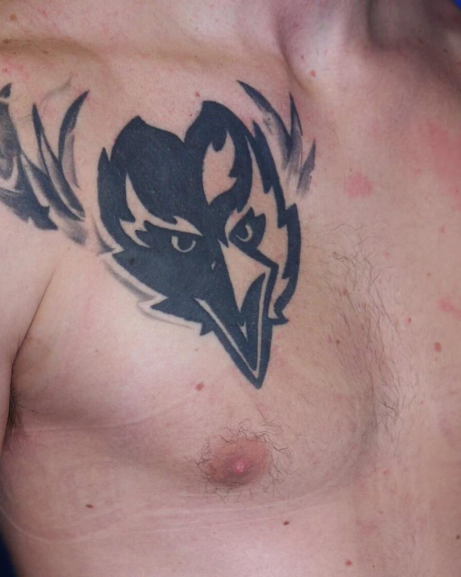 One-Stitch Gynecomastia after
