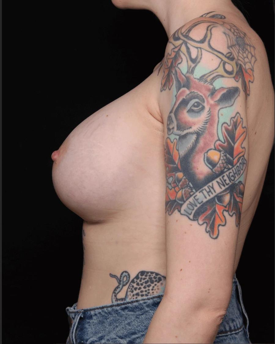 Breast Augmentation with Implants, Right Profile view, after