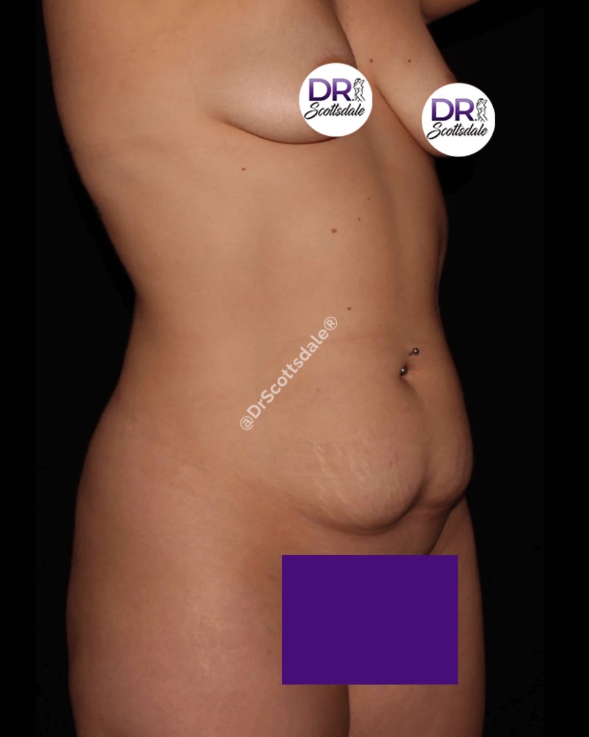 Scottsdale Skinny before