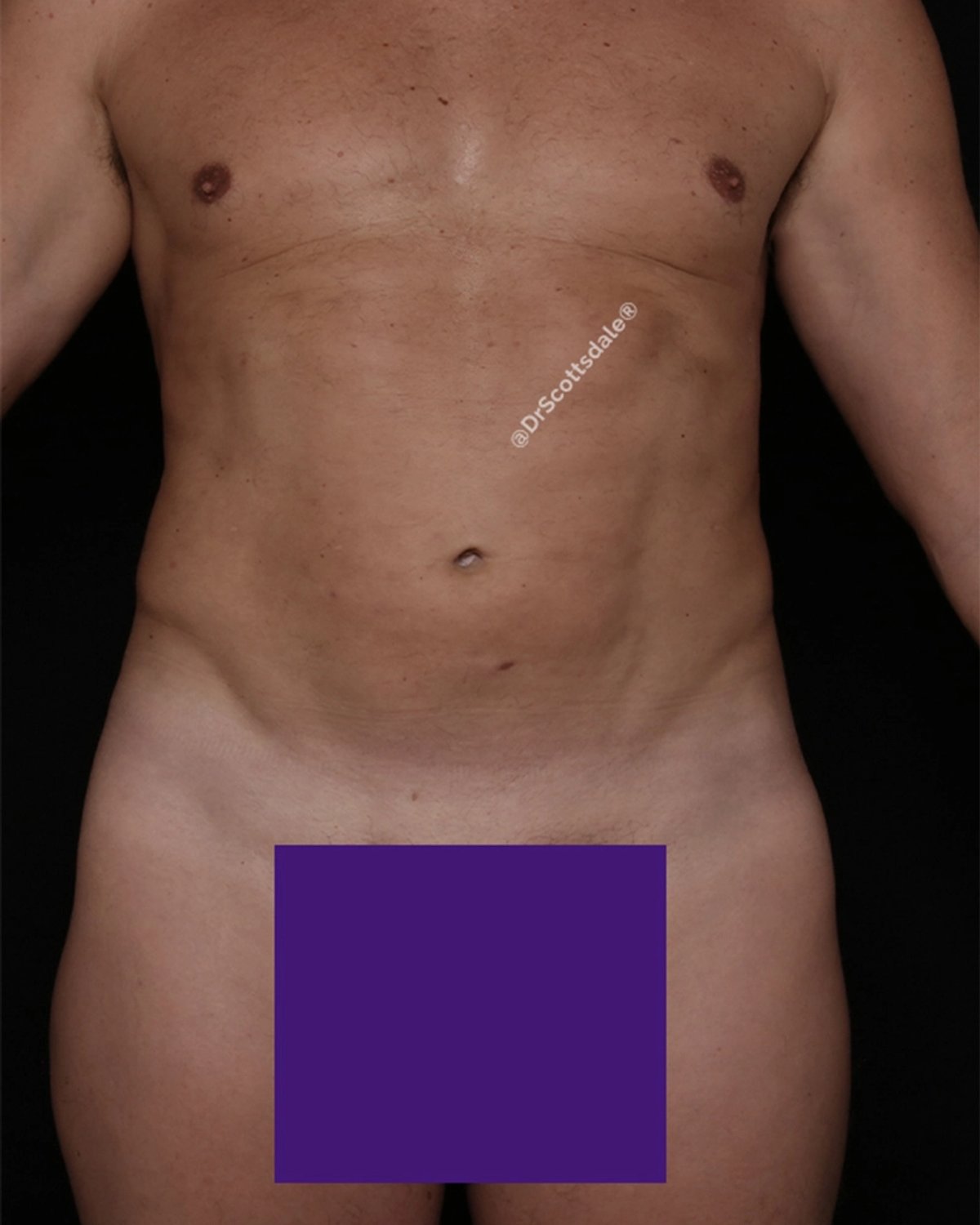 Gladiator after