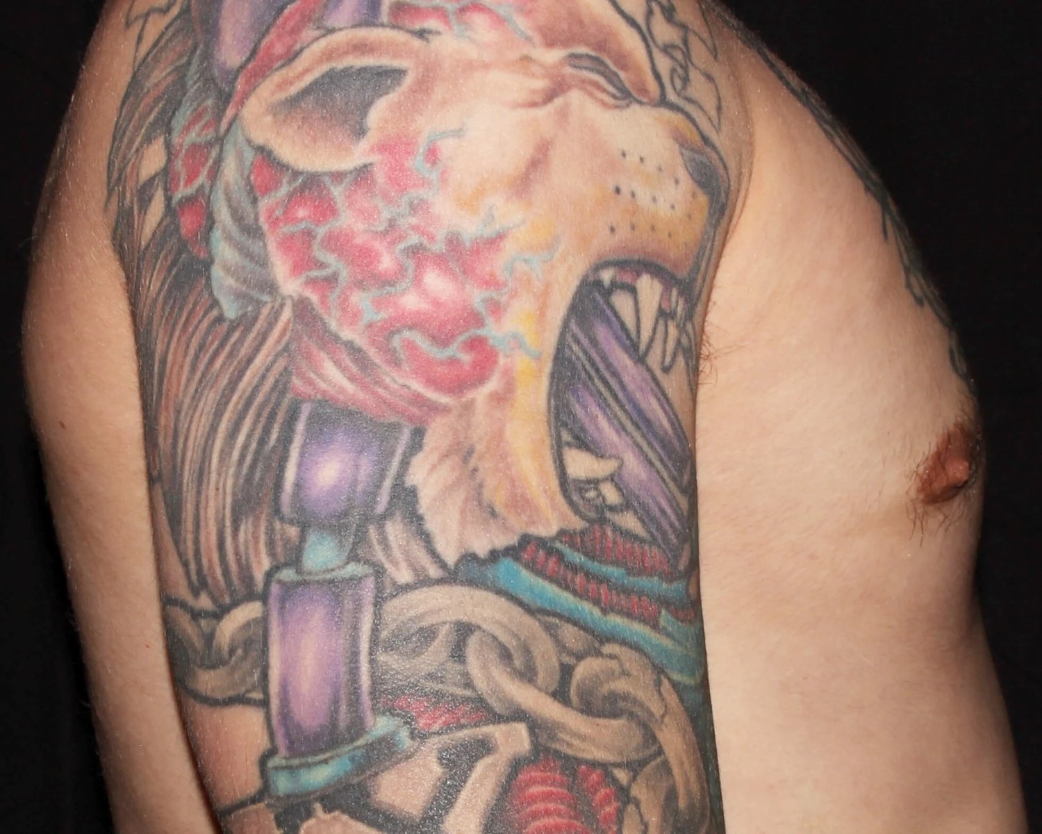 One-Stitch Gynecomastia — Oblique Right view, after