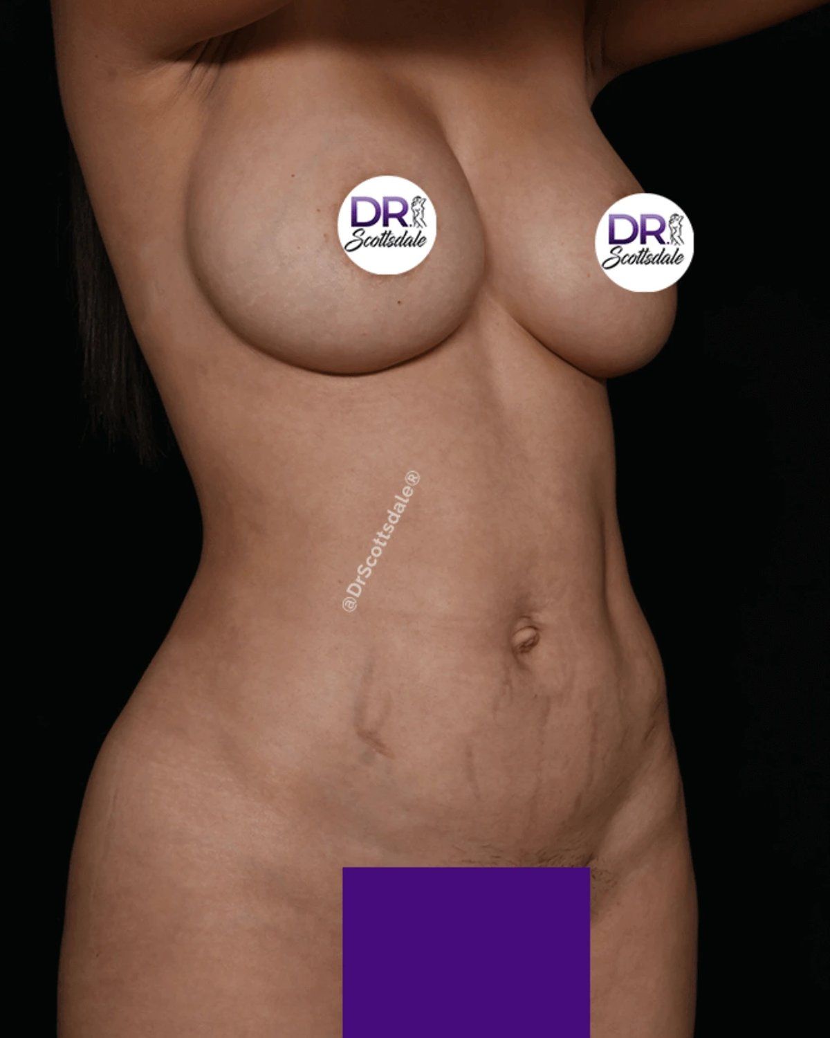 Scottsdale Skinny after
