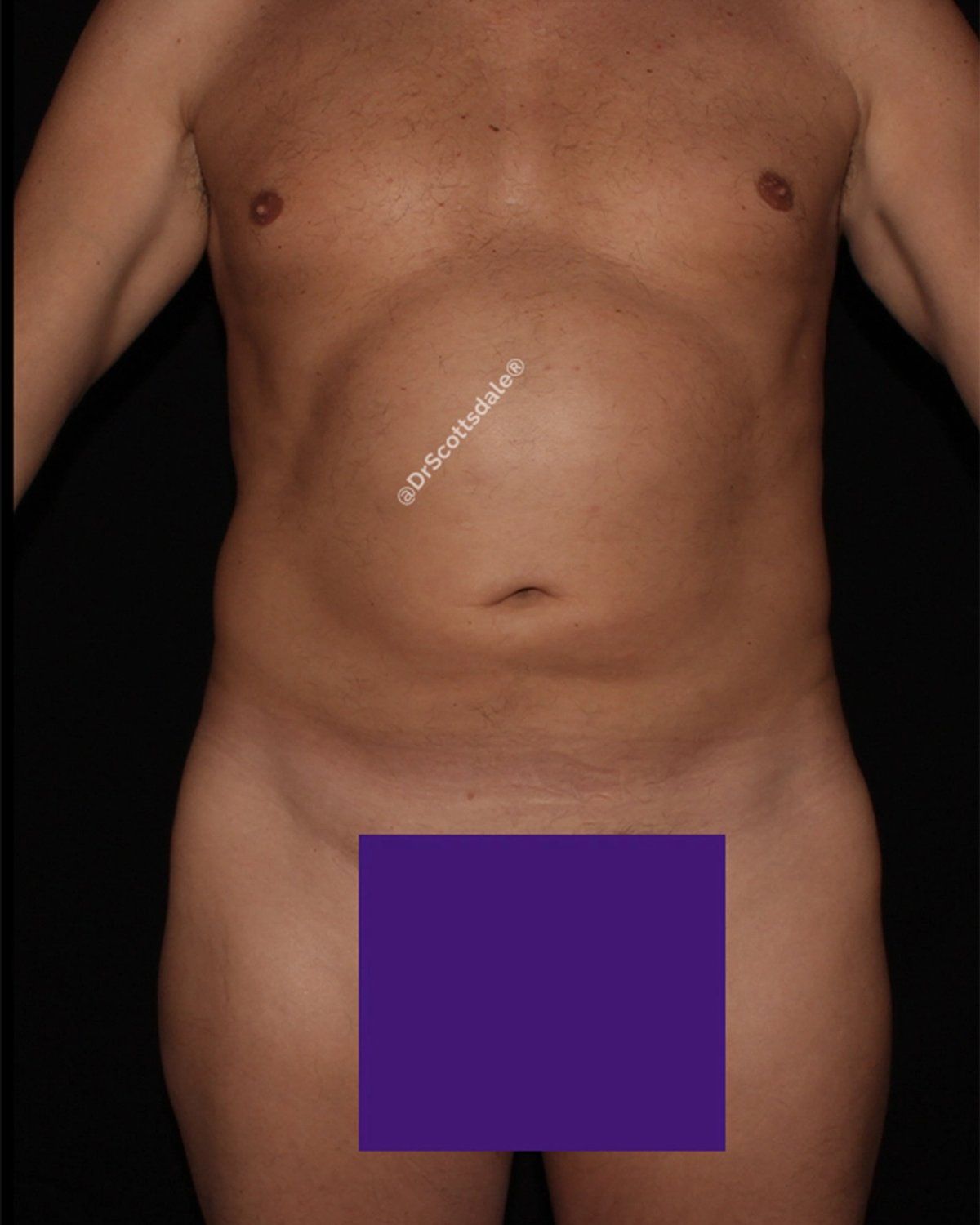 Gladiator before