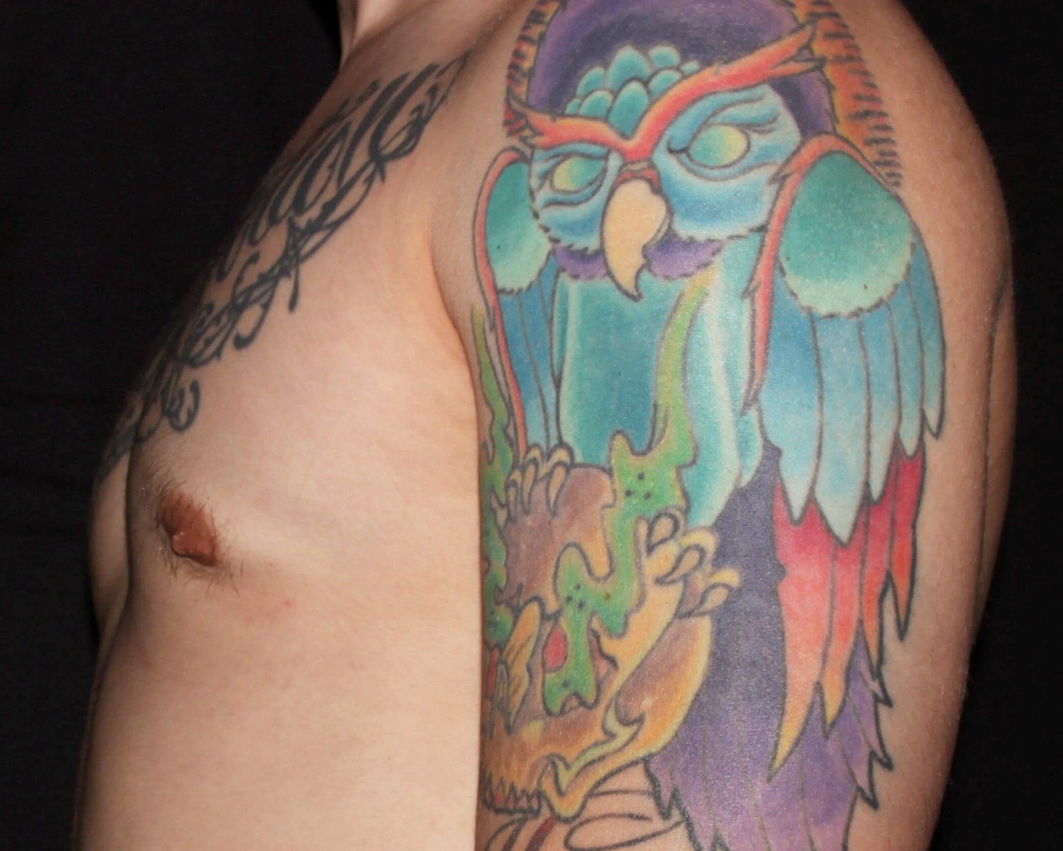 One-Stitch Gynecomastia — Oblique Left view, after