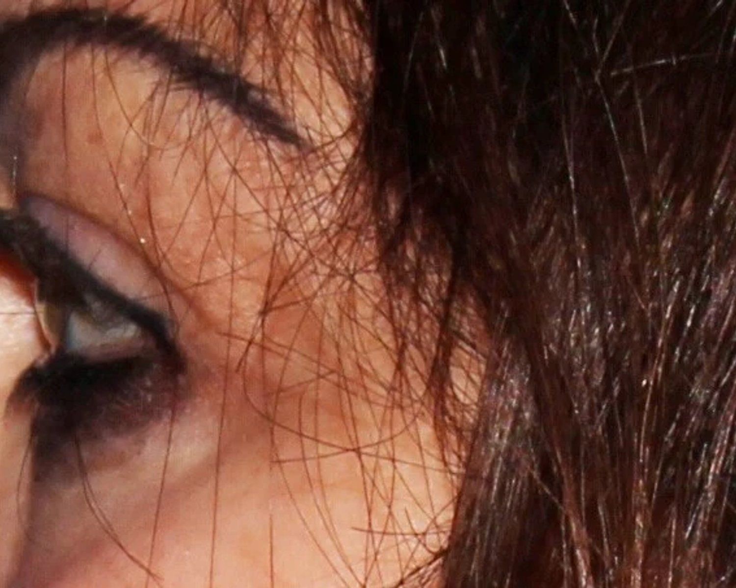 Eyelid Surgery, Oblique Left view, before